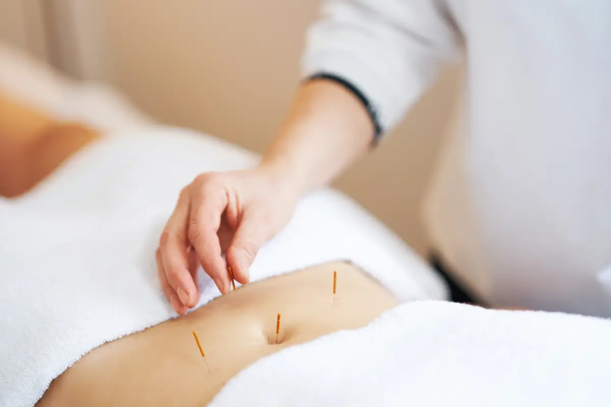 Can Acupuncture Help with Weight Loss?