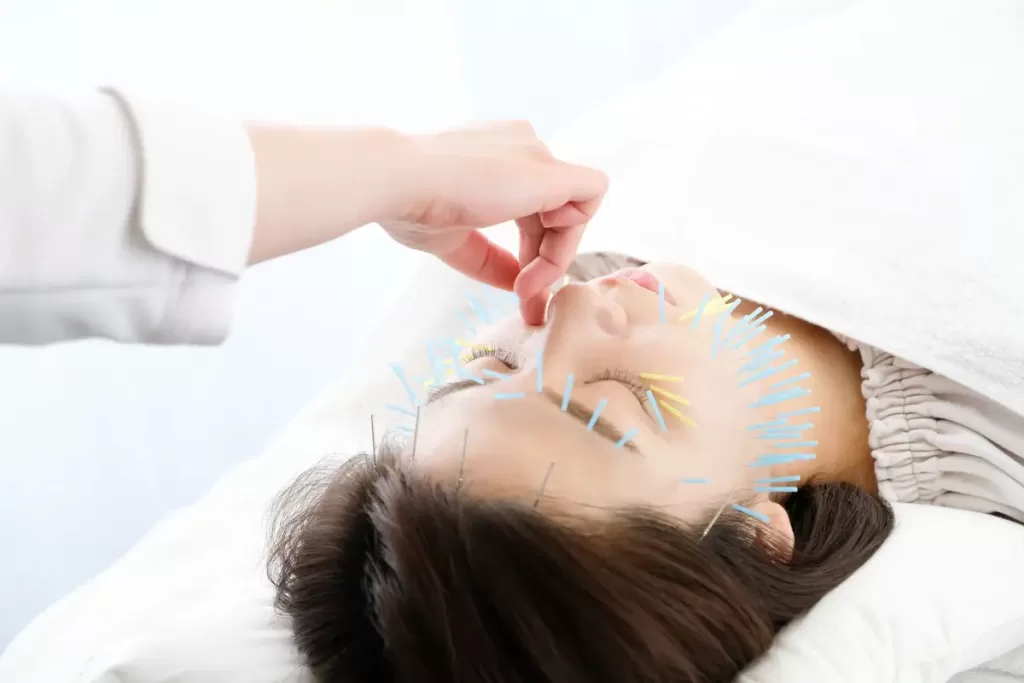 Acupuncture Sessions are Needed for Results