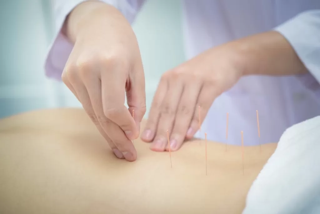 Know Before Your First Acupuncture Session