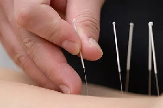 What type of needles are used in acupuncture